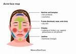 Skin Breakout