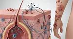 Skin Outbreaks