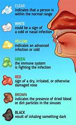 Snot Meaning