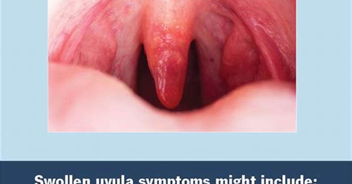 Sore Uvula