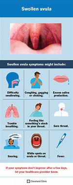 Sore Uvula
