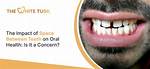 Space Between Front Teeth