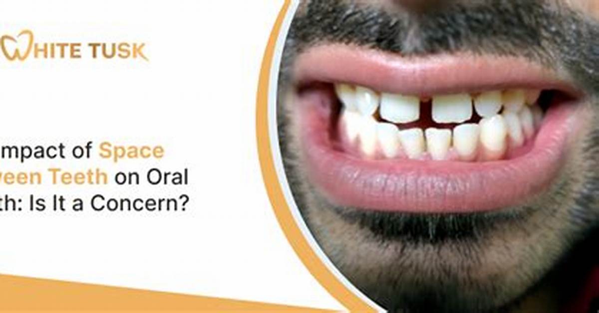 Space Between Two Teeth