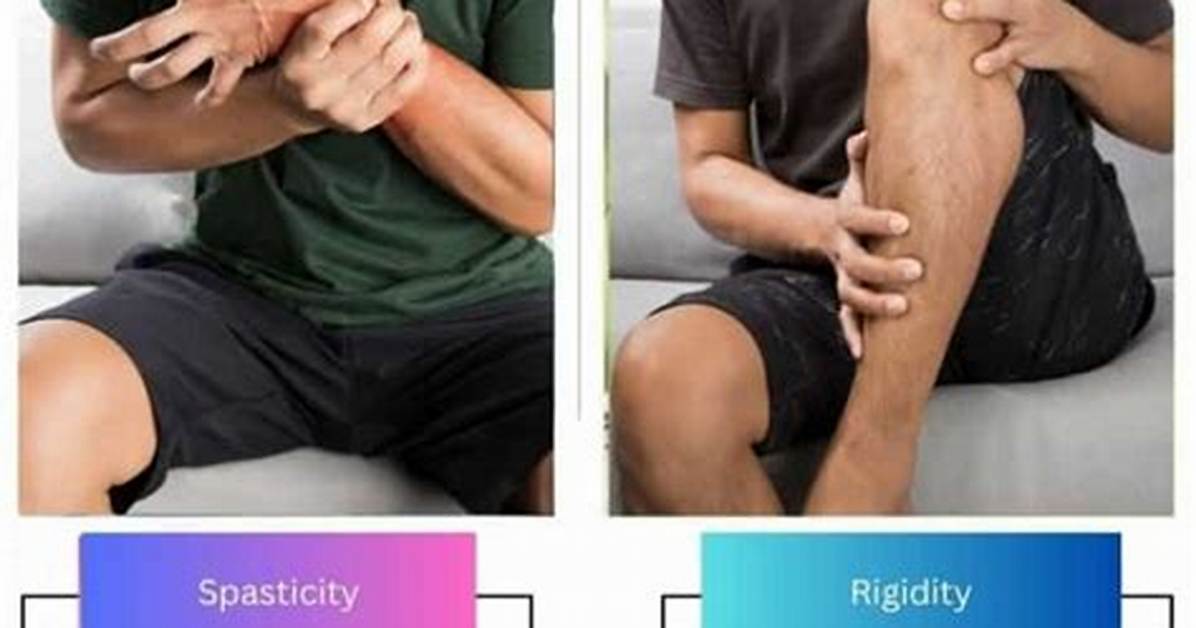 Spasticity vs Rigidity