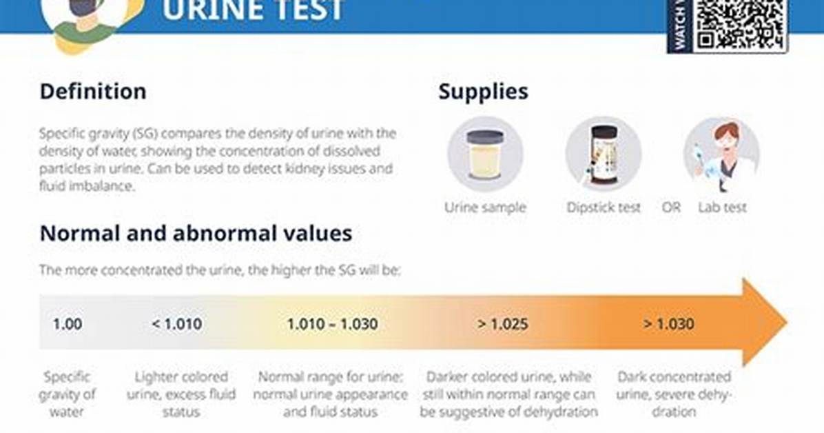 Specific Gravity Normal Range