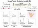 Spep Test