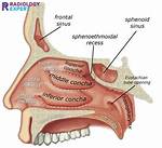 Sphenoethmoidal Recess