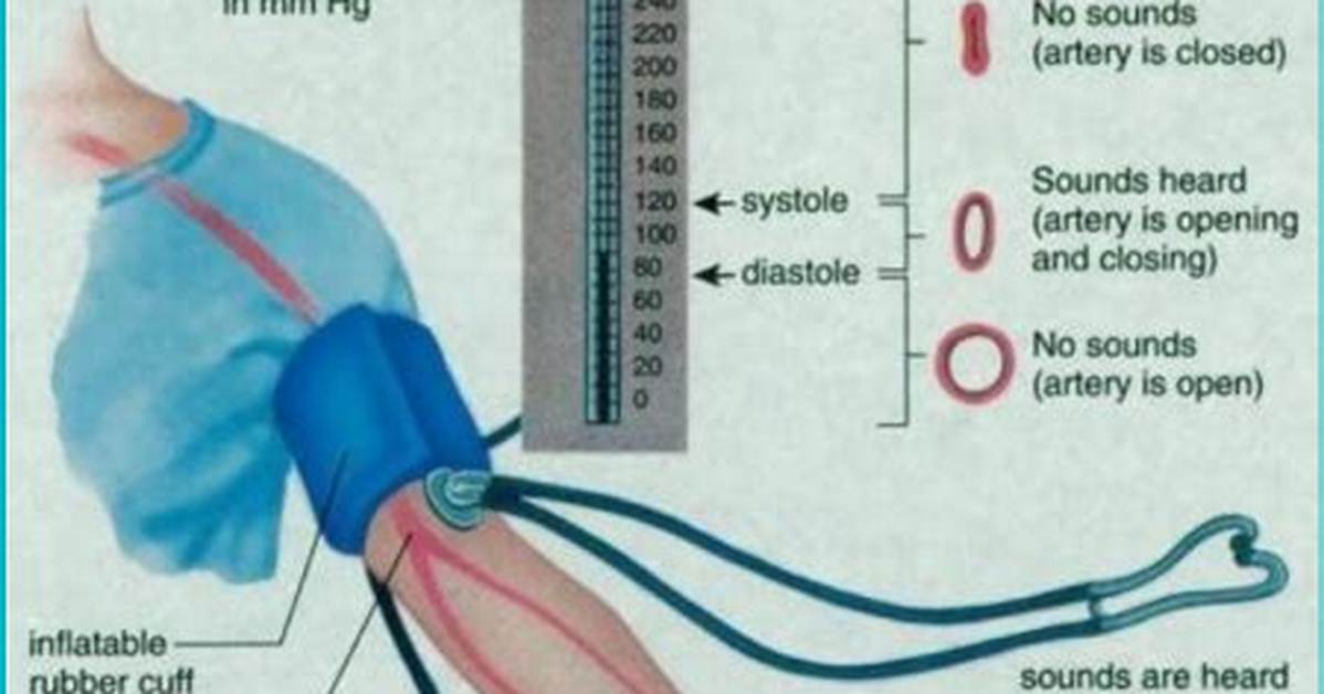 Sphygmomanometer Definition