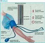 Sphygmomanometer Definition