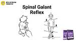 Spinal Galant Reflex