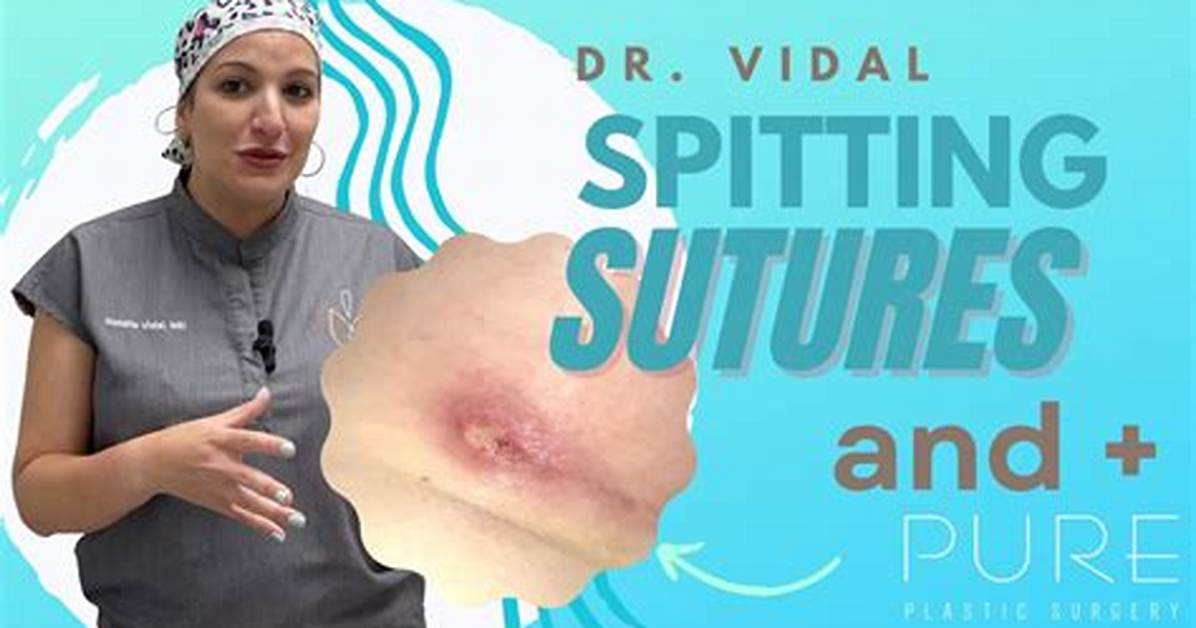 Spitting Stitches