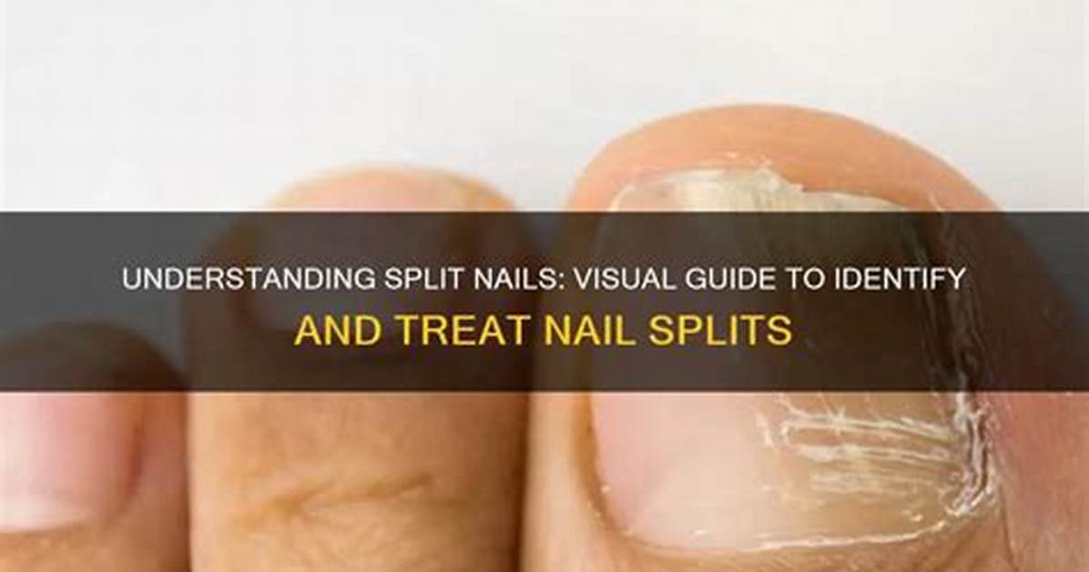 Split Nail