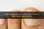 Split Nail