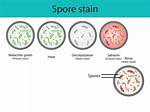Spore Stain