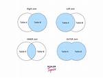 Sql Union vs Join