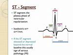 St Segment Represents