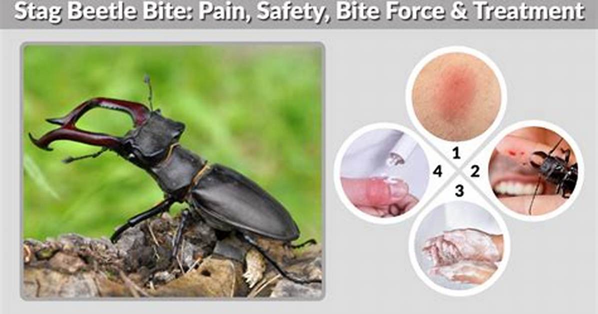 Stag Beetle Bite