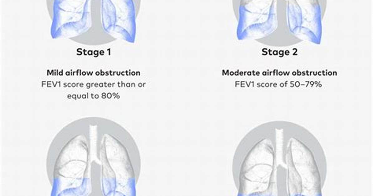 Stage 3 Copd