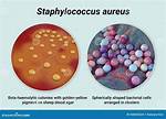 Staphylococcus Aureus Shape