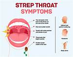 Strep Without Fever