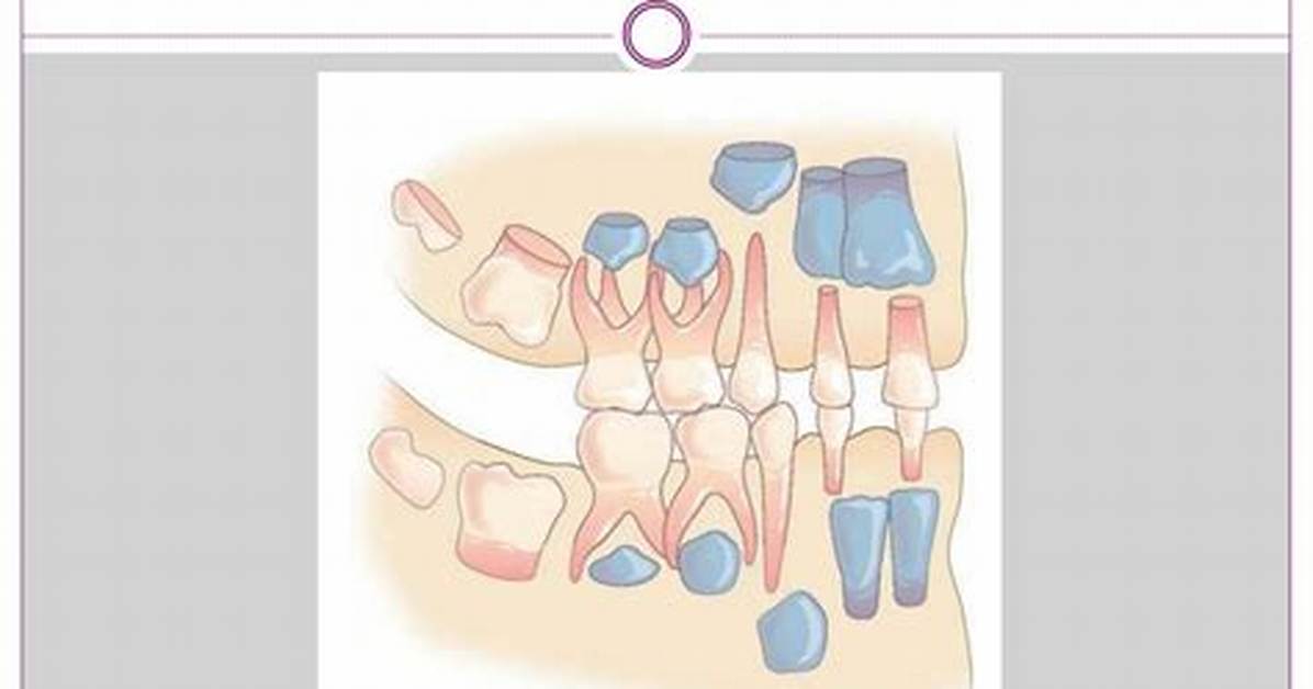 Succedaneous Teeth