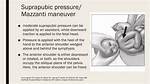 Suprapubic Pressure