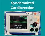 Synchronized Cardioversion Joules