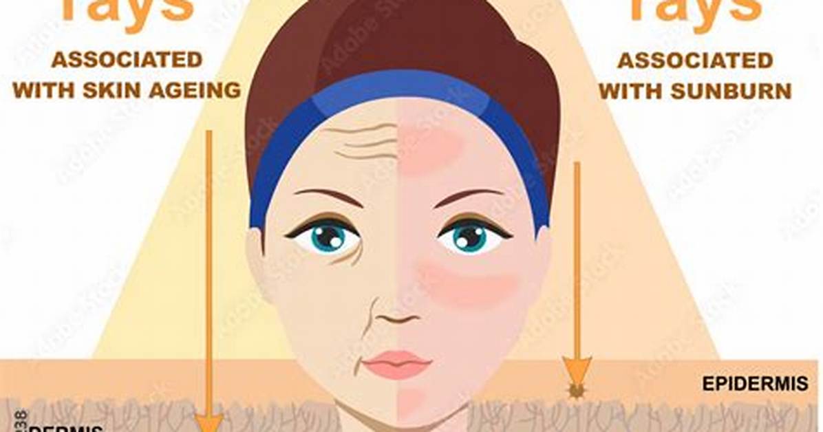 Tan-Causing Ray: Abbr.