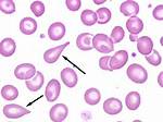 Tear Drop Cells