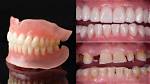 ___ Teeth (Dentures)