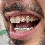 Teeth Grill