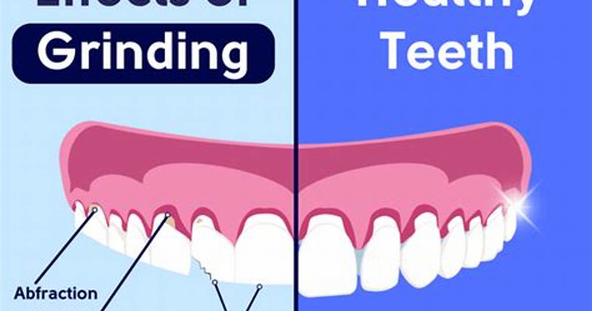 Teeth That Grind