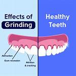 Teeth That Grind