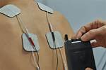 Tens Machine Side Effects