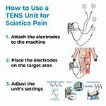 Tens Unit Placement for Sciatica