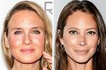 The Drastic Difference Plastic Surgery Makes on Celebrities of the Same Age