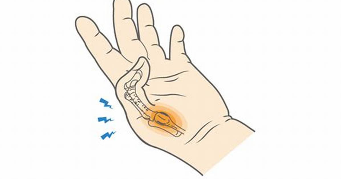 Thumb Lock