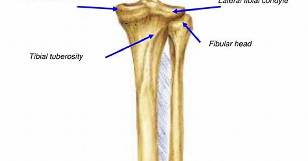 Tibial Condyle