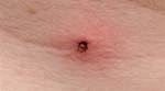 Tiny Bite