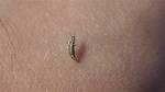 Tiny Biting Insect