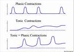 Tonic Contraction