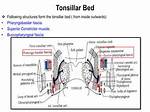 Tonsillar Bed