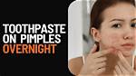 Toothpaste on Pimples Overnight