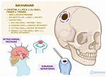 Trephining Definition
