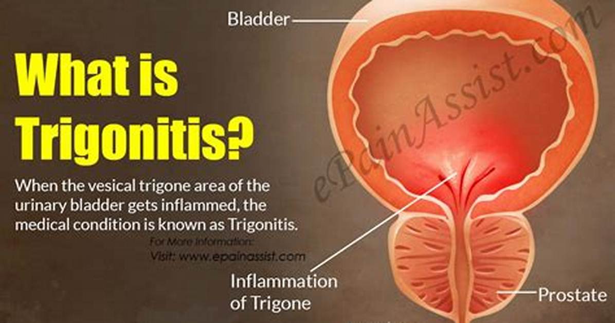 Trigonitis