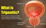 Trigonitis