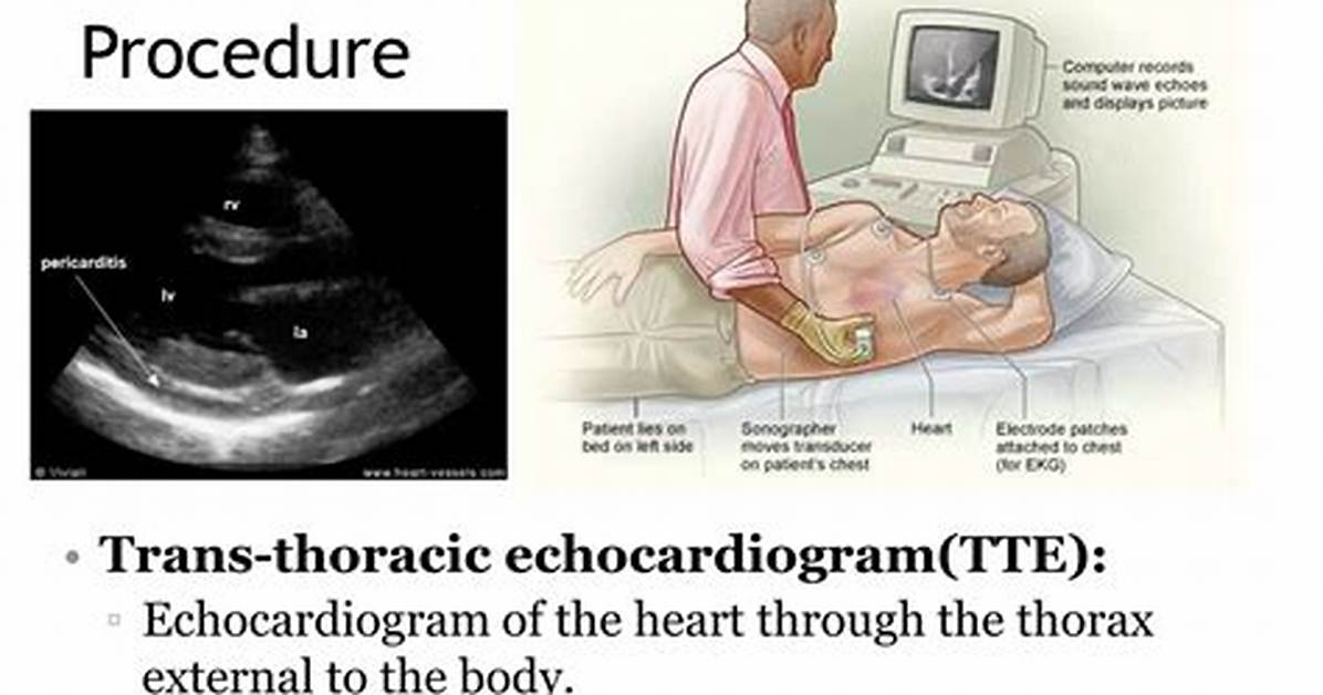 Tte Procedure