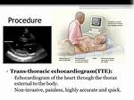 Tte Procedure