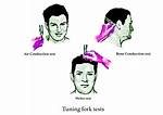 Tuning Fork Test