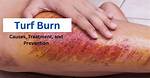 Turf Burn